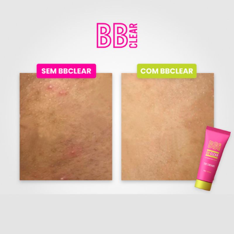 bb-clear-clareador-de-manchas-75ml-3